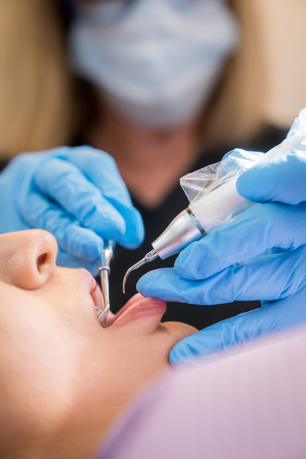 Close view of a periodontal cleaning procedure